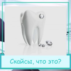 Скайсы, что это?